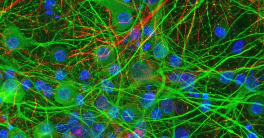 Desarrollan un recubrimiento que perfora bacterias al contacto y podría cambiar el control de infecciones hospitalarias