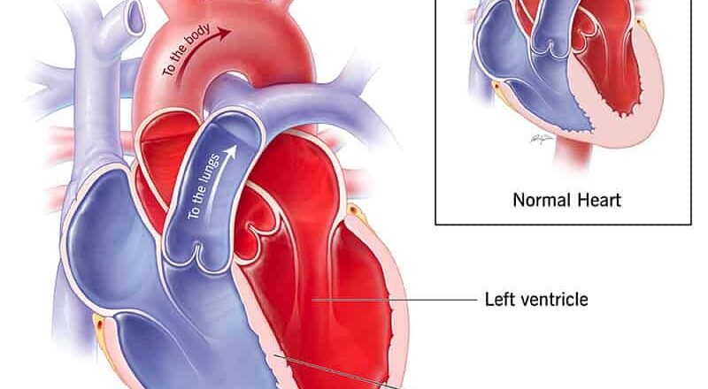 Un nuevo estudio revisa cómo el consumo de alcohol impacta en la salud cardiovascular