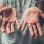 España pierde el estatus de país libre de sarampión: qué implica para la salud pública