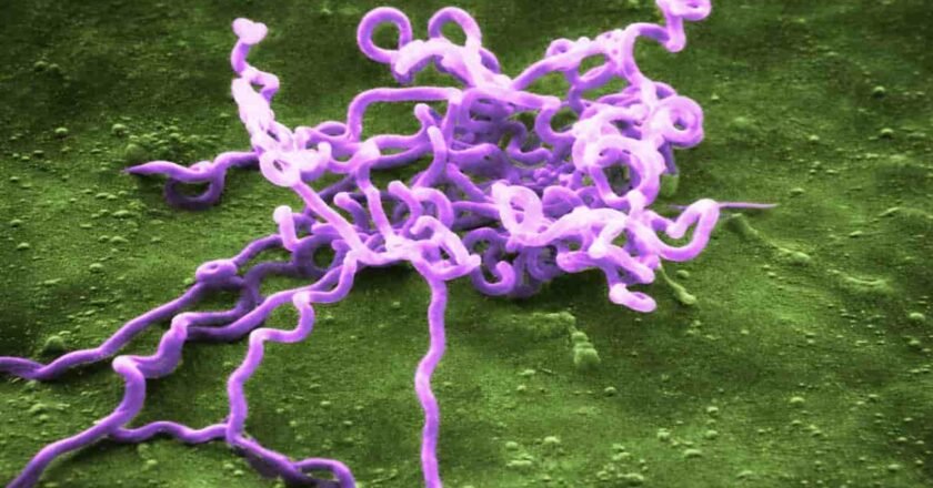 Sífilis: un cazador prehistórico y el origen profundo de una enfermedad moderna