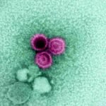 Un estudio confirma que el virus de Epstein-Barr puede causar esclerosis múltiple