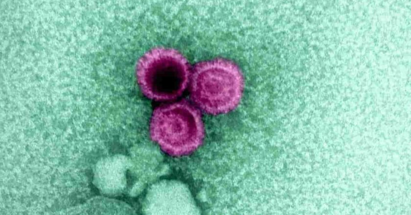 Un estudio confirma que el virus de Epstein-Barr puede causar esclerosis múltiple