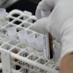 Identifican una proteína que impulsa el cáncer de mama más agresivo y abre una nueva vía terapéutica