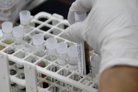 Identifican una proteína que impulsa el cáncer de mama más agresivo y abre una nueva vía terapéutica