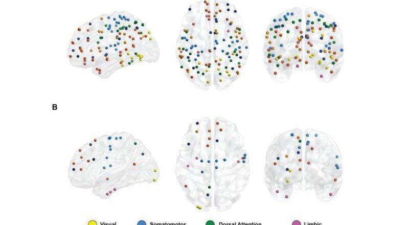 Las matemáticas descubren cambios en la conectividad cerebral en el autismo y el envejecimiento
