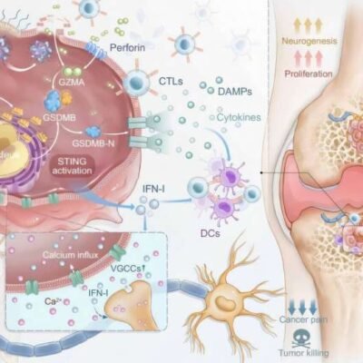 Una nanoterapia desarrollada en China promete aliviar el dolor de las metástasis óseas con mayor precisión