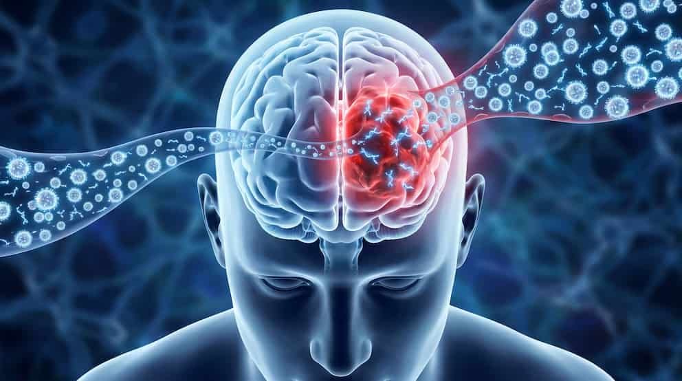 Nanopartículas con ARN muestran avance contra glioblastoma