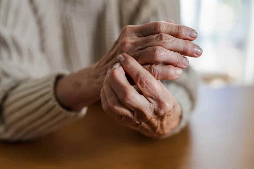 Abatacept reduce el riesgo de artritis reumatoide