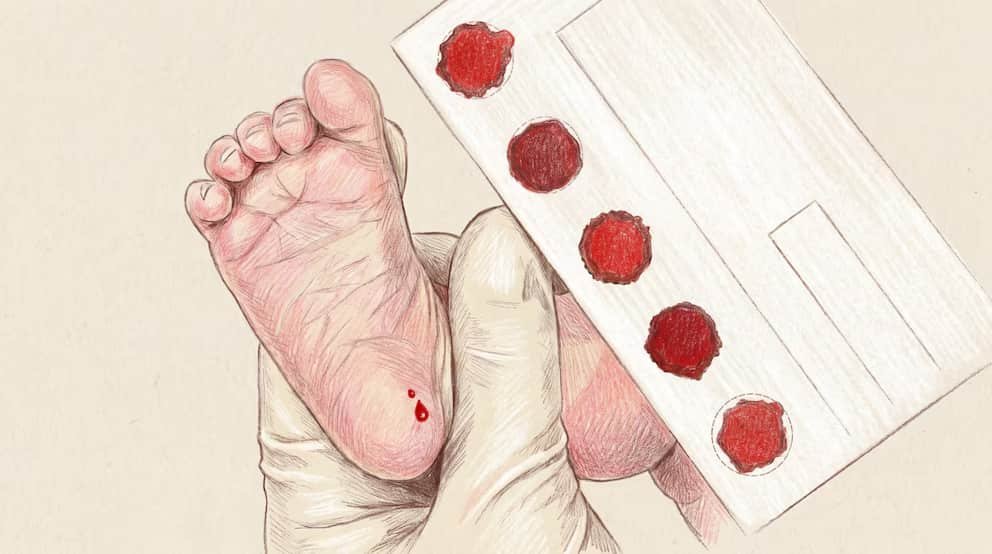 La pesquisa neonatal puede cambiar la vida de un recién nacido