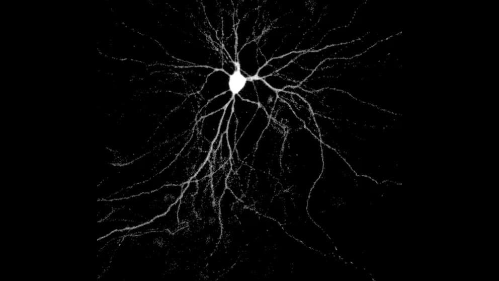Hallan cómo la proteína Arc ayuda a expandir el Alzheimer entre neuronas