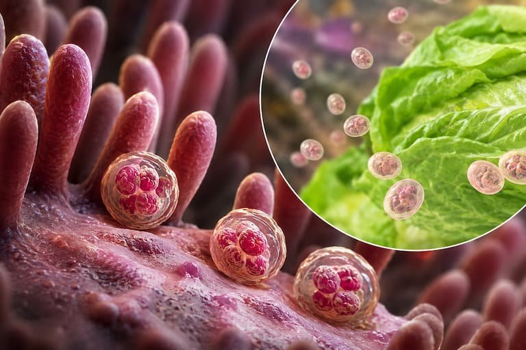 Brote de ciclosporiasis supera los 11.500 casos en Estados Unidos