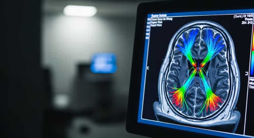 Una sola dosis de cocaína deja huellas genéticas en el cerebro