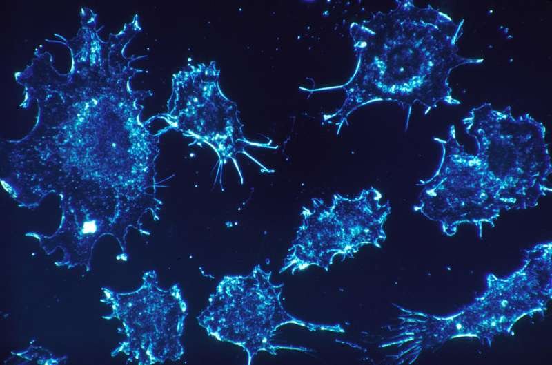 Descubren cómo las células cancerosas evitan al sistema inmune