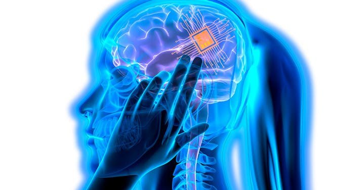 El implante cerebral chino, NEO, marca un cambio de era en la medicina y la sociedad