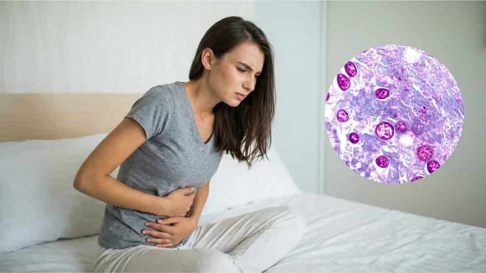 Brote de ciclosporiasis se extiende a 20 estados de EE. UU.