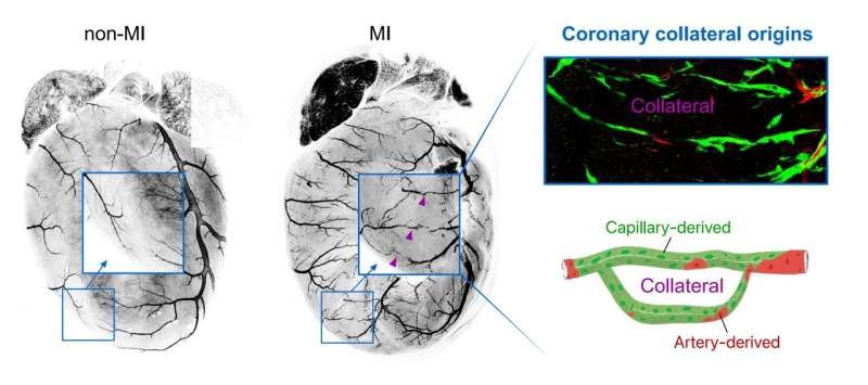 Los capilares crean desvíos naturales tras un infarto