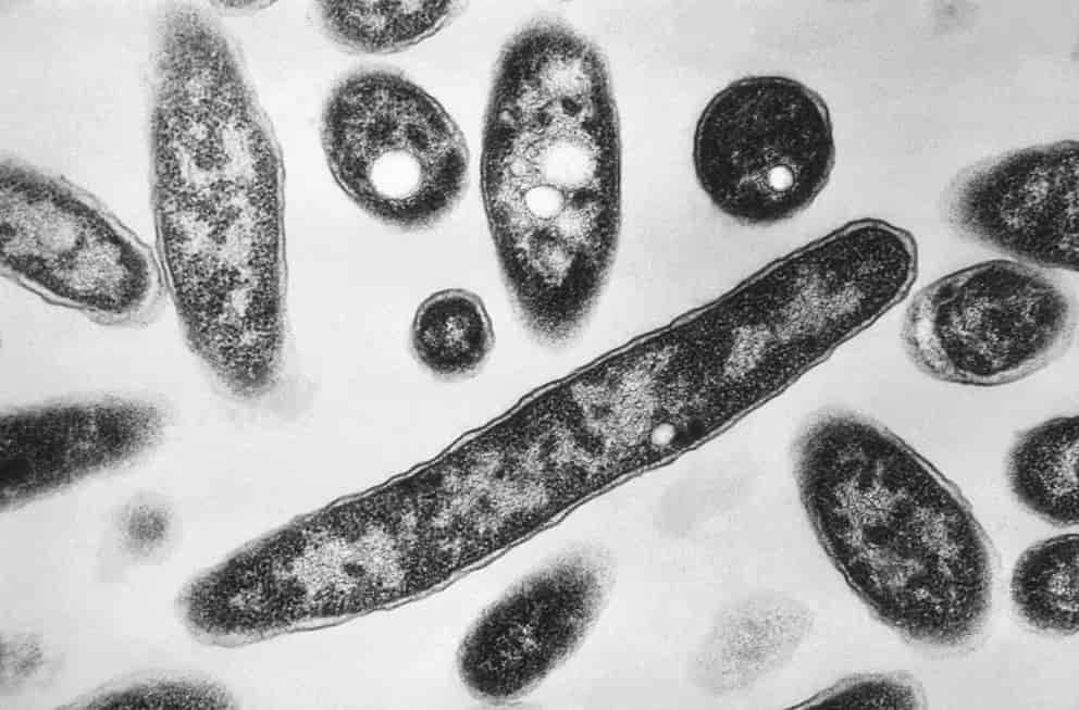 Nueva York cierra la fase crítica del brote de legionelosis