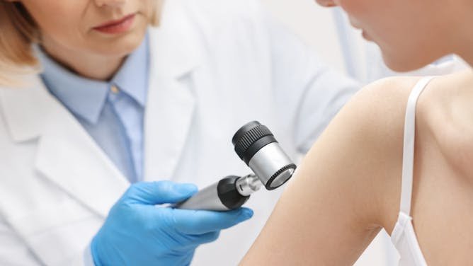 La vacuna personalizada contra el melanoma supera una prueba decisiva