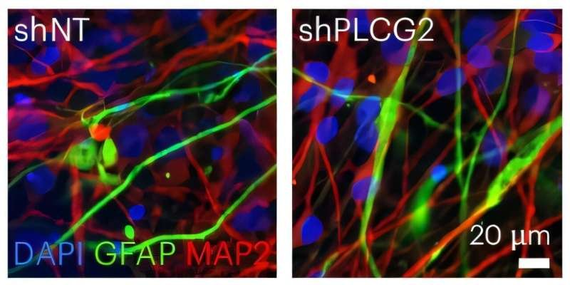 Variantes raras del gen PLCG2 elevan el riesgo de Alzheimer
