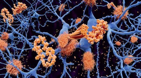 Catestatina reduce señales del Alzheimer en un estudio con ratones