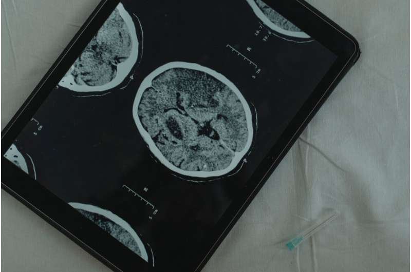 Una infección intestinal puede entrenar defensas en las meninges