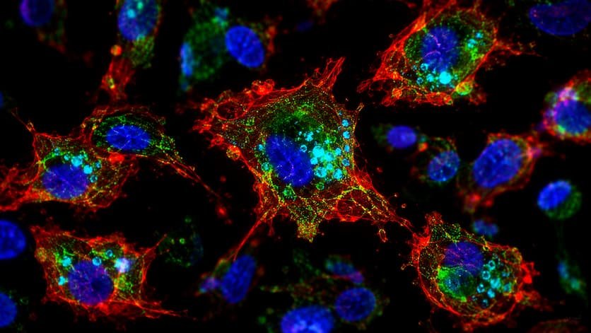 Un fármaco antiparasitario modificado reduce lesiones de endometriosis en ratones