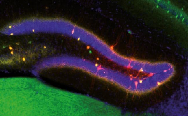 El cerebro ajusta cuándo actualizar o conservar un recuerdo